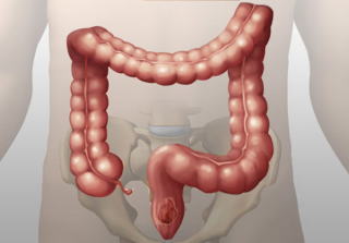 大腸のイメージ図
